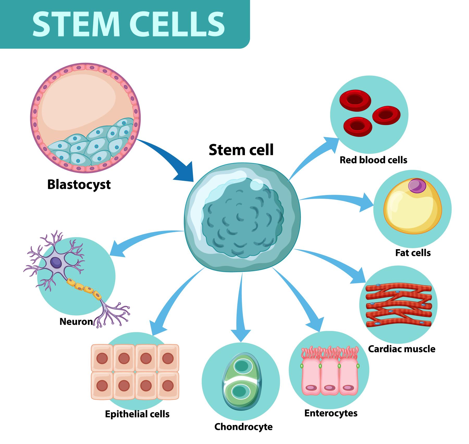 Stem Cell Transplant: A Promising Treatment for Various Diseases